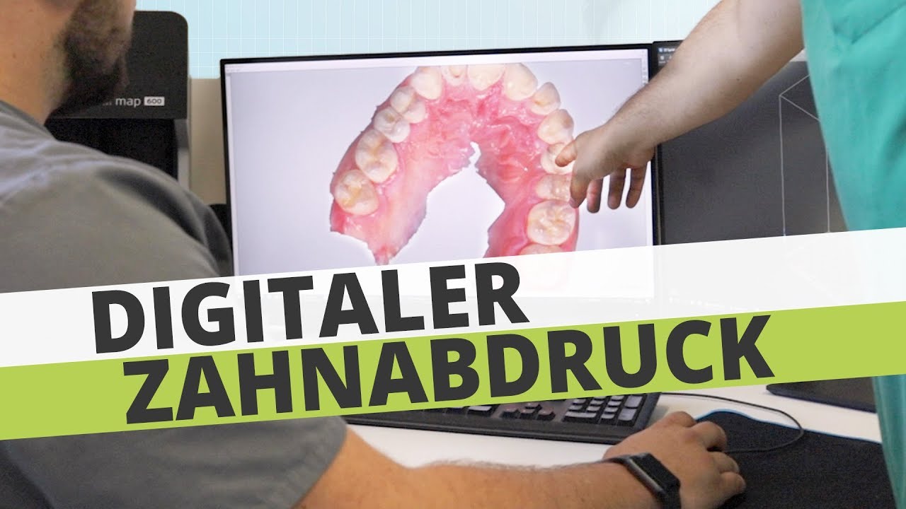 Digitaler Zahnabdruck beim Zahnarzt - Digitale Zahnmedizin - 360&deg;zahn