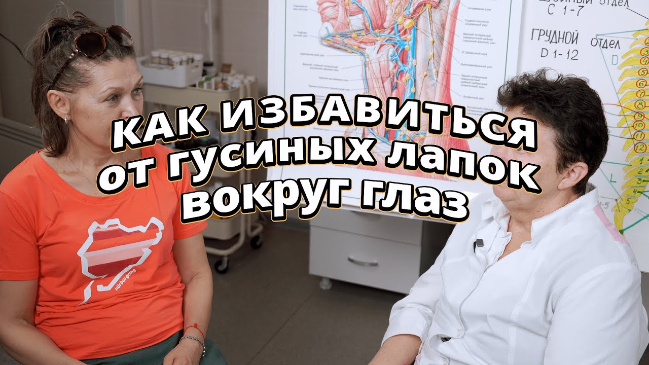 Как не допустить гусиных лапок на лице и отечности глаз!