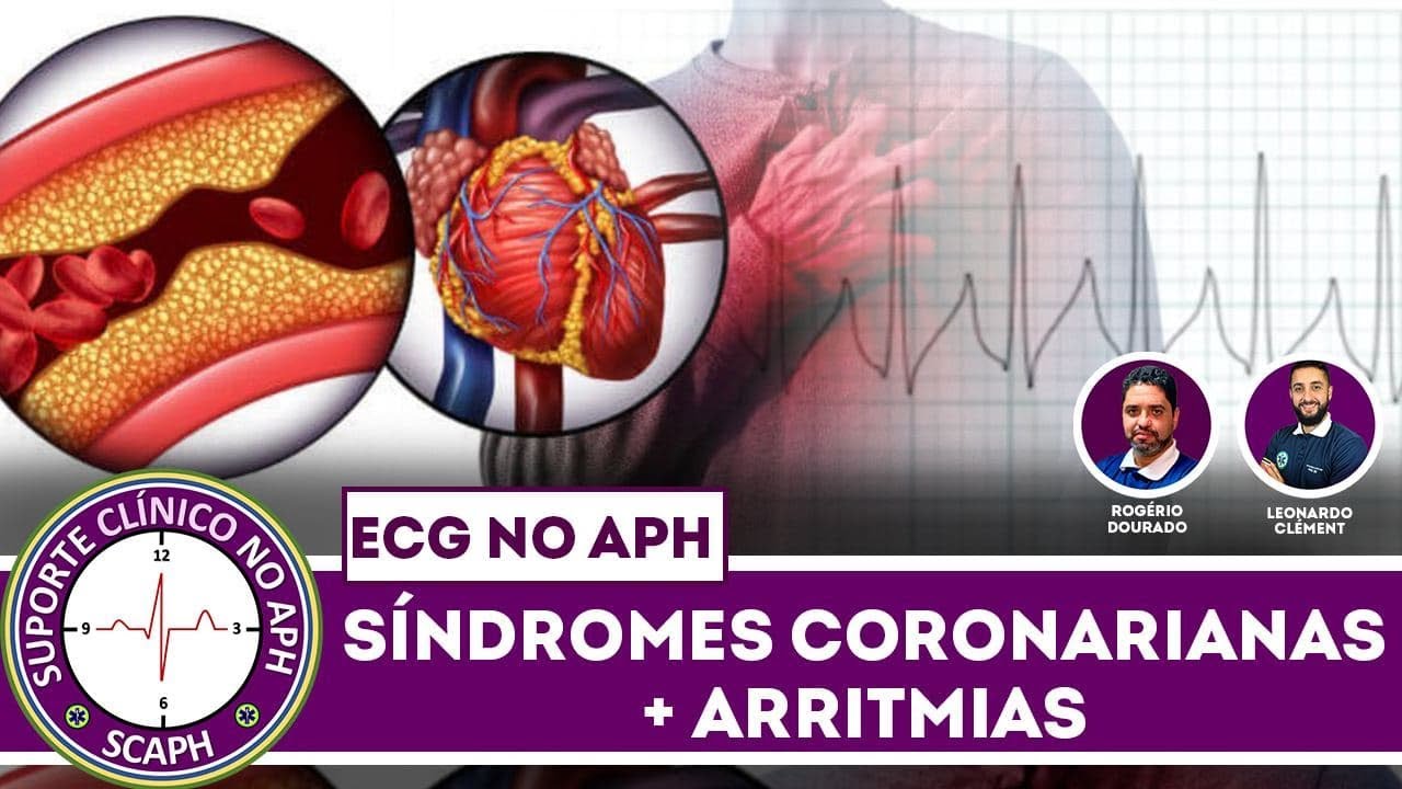 [LIVE] ECG no APH: foco no Infarto Agudo do Miocárdio (IAM) e nas arritmias