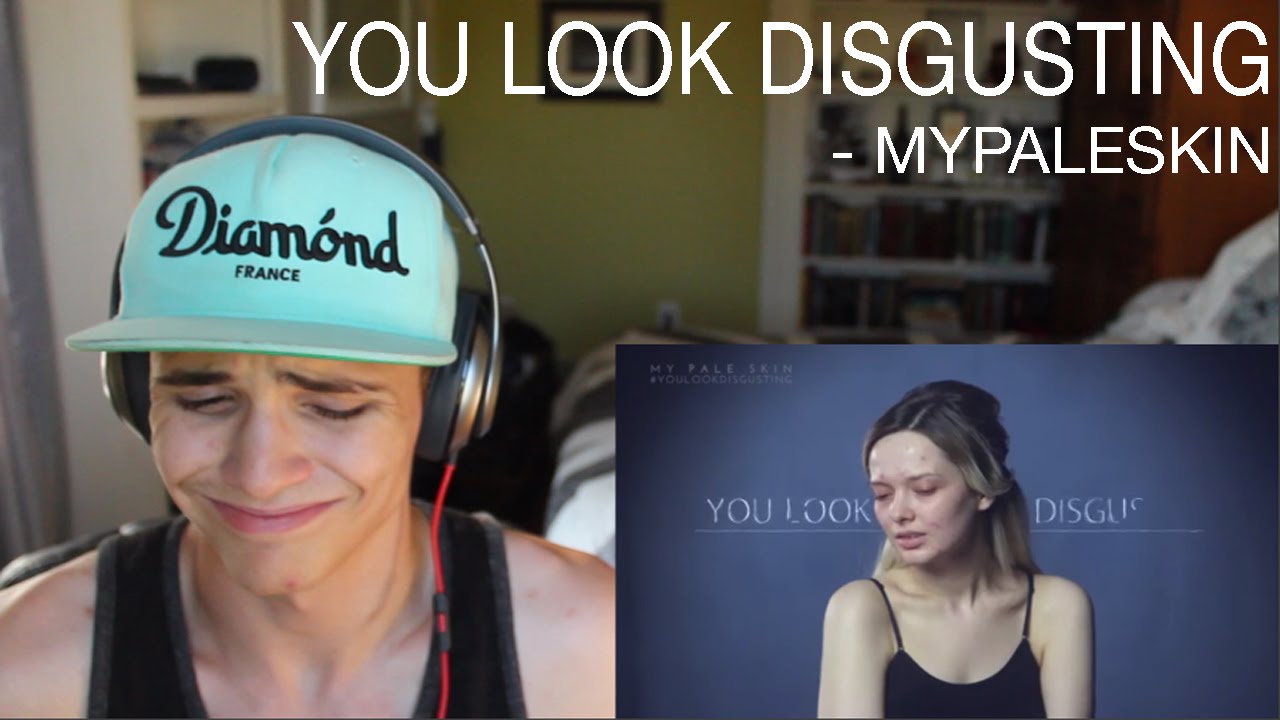 You Look Disgusting by My Pale Skin | Reaction