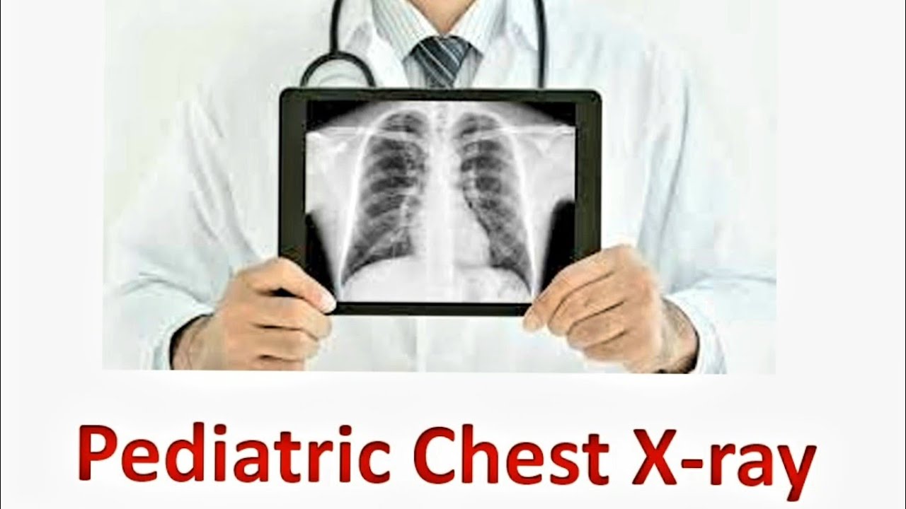 Lecture 12 | Chest X-ray  #د_محمد_ابوبكر_صبيح