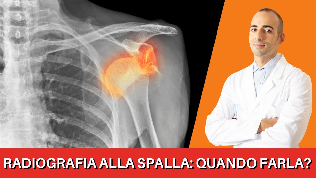 Quando è giusto fare una RADIOGRAFIA con DOLORE alla SPALLA.