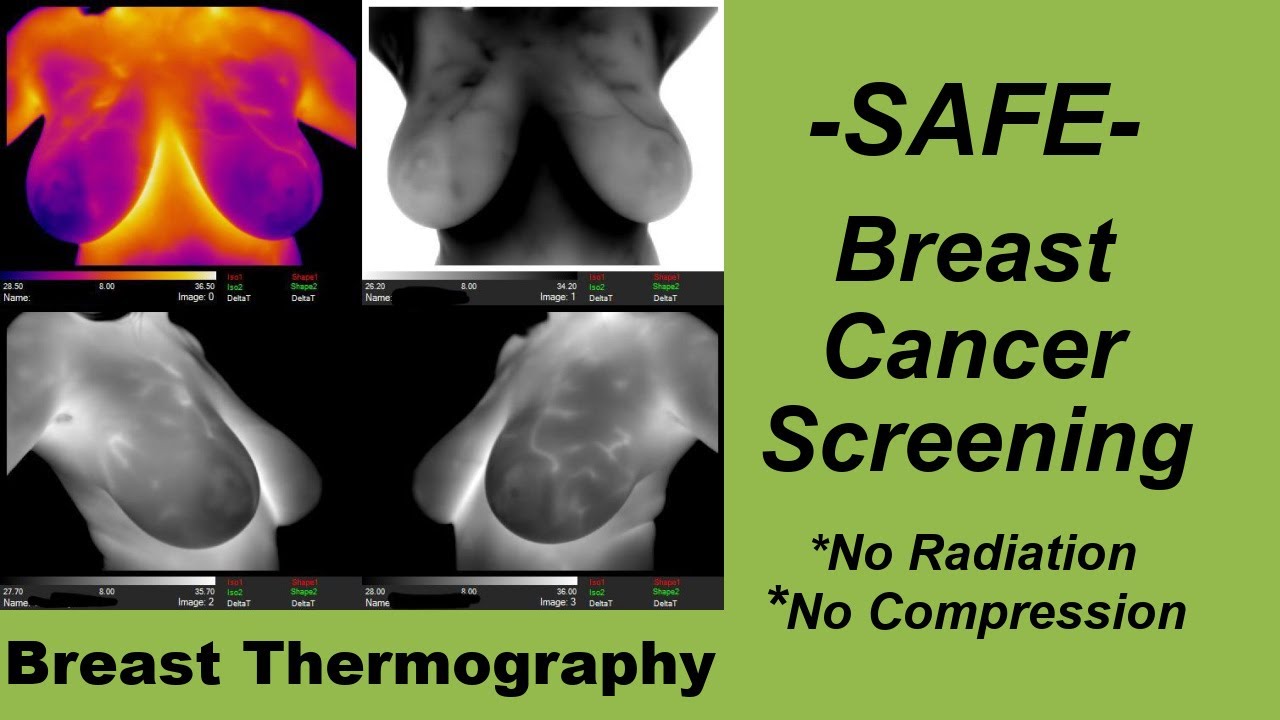 Breast Thermography: Safe breast cancer screening.