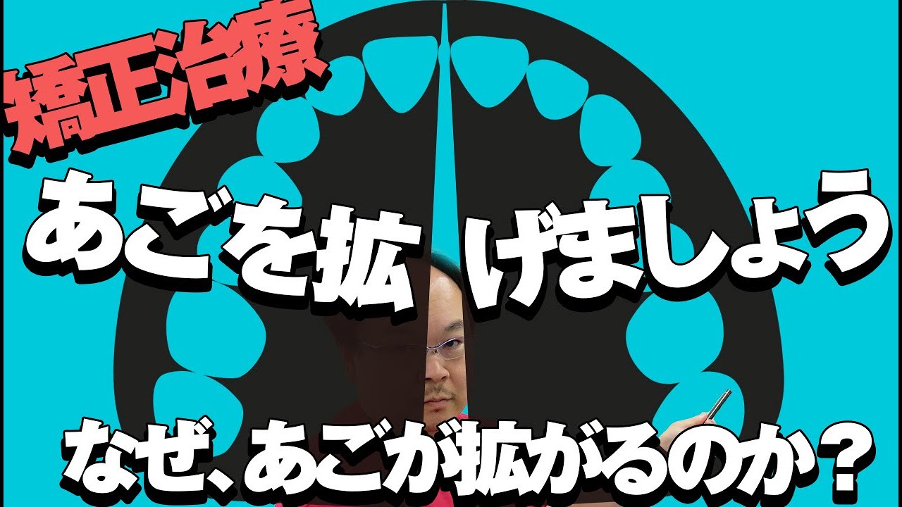 あごを拡げましょう？どういう事？矯正治療で言われる顎が拡がるメカニズムについて和歌山市の歯科医院院長が説明します。