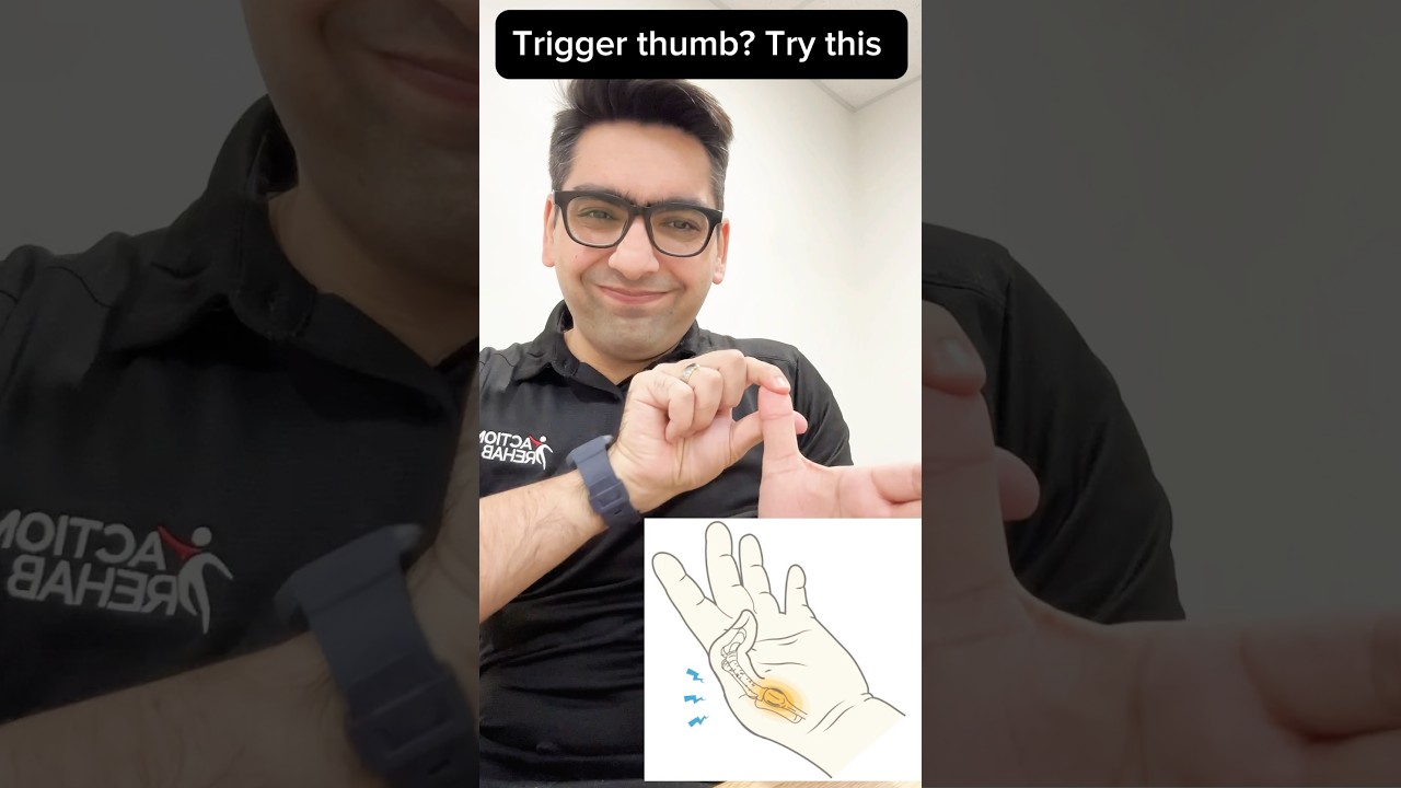 Trigger Thumb relief in seconds! #trigger #thumbpain #thumb #painrelief #foryou #finger #fingerjoint