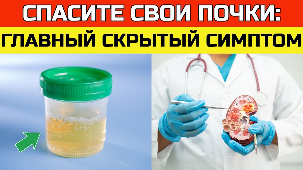 №1 ранний признак поражения почек, который большинство игнорирует | ЗДОРОВЬЕ ПОСЛЕ 50