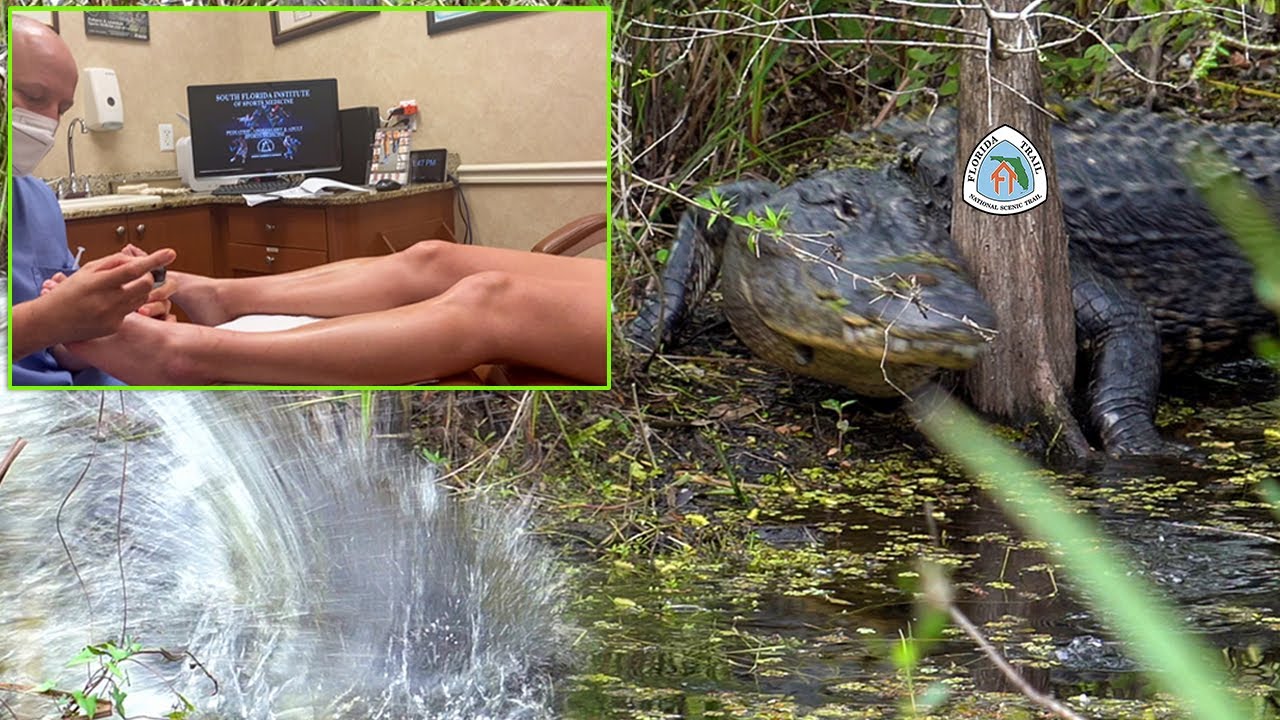 10 Alligators In A Day (plus More Toe Problems)