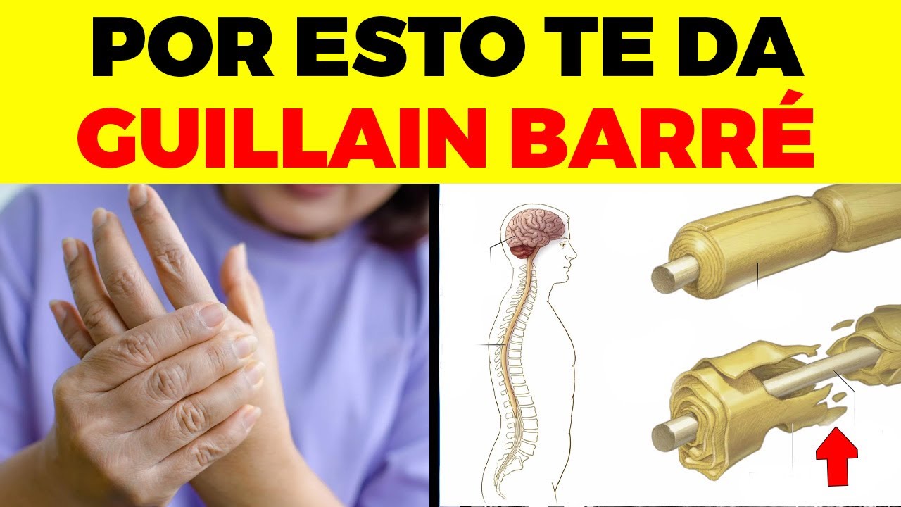 ¡ALERTA! Este error común CAUSA GUILLAIN BARRÉ,  no lo hagas