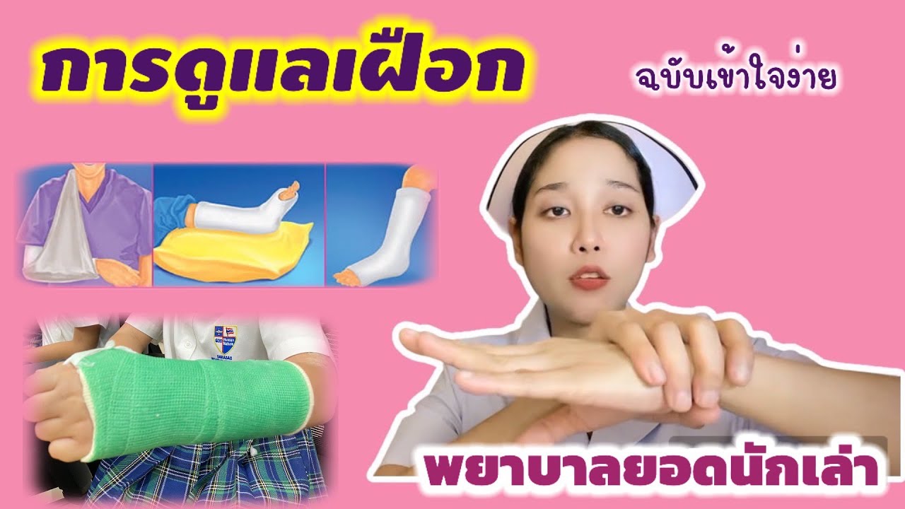 “การดูแลเฝือก” มาเรียนรู้วิธีการดูแลเฝือกแบบง่ายๆ ดูแล้วใครๆก็ทำได้ #พยาบาลยอดนักเล่า