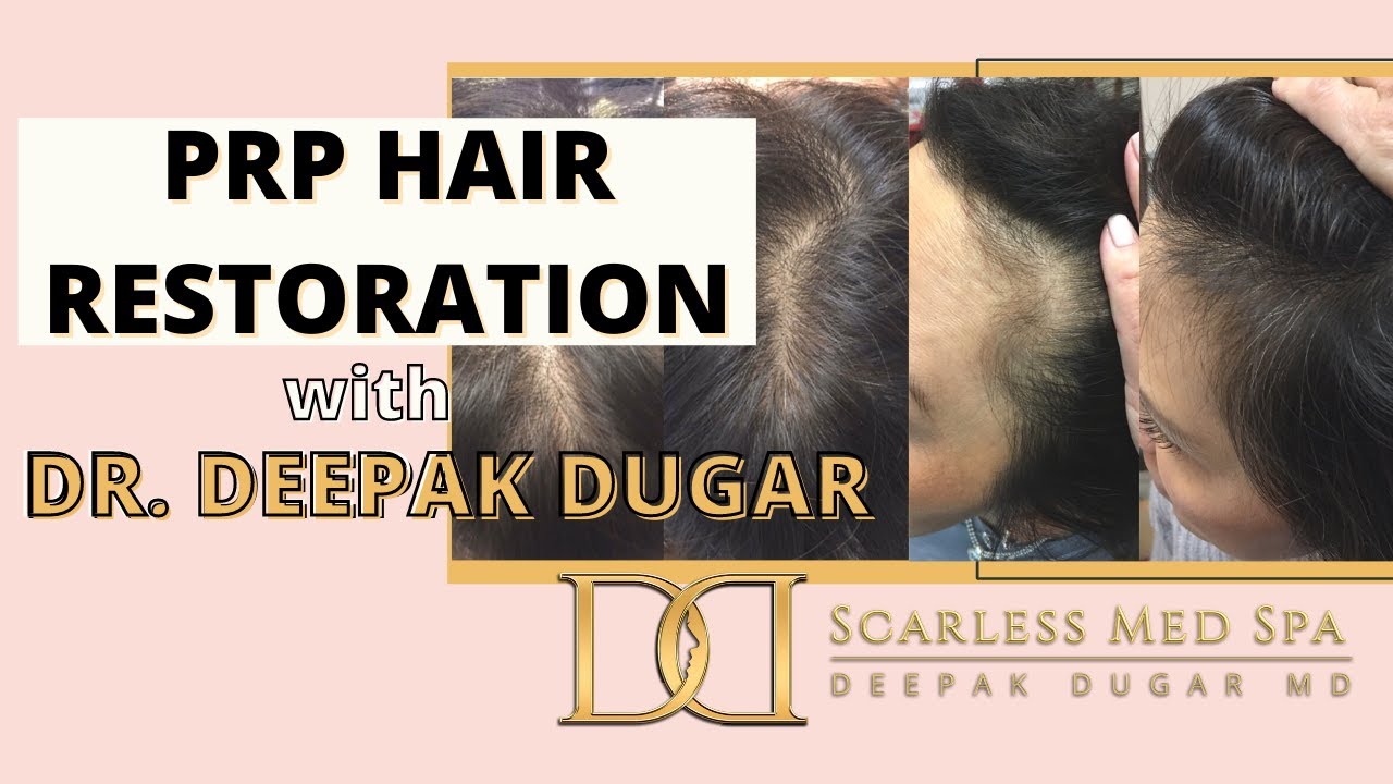 PRP Hair Restoration with Dr. Dugar, Beverly Hills