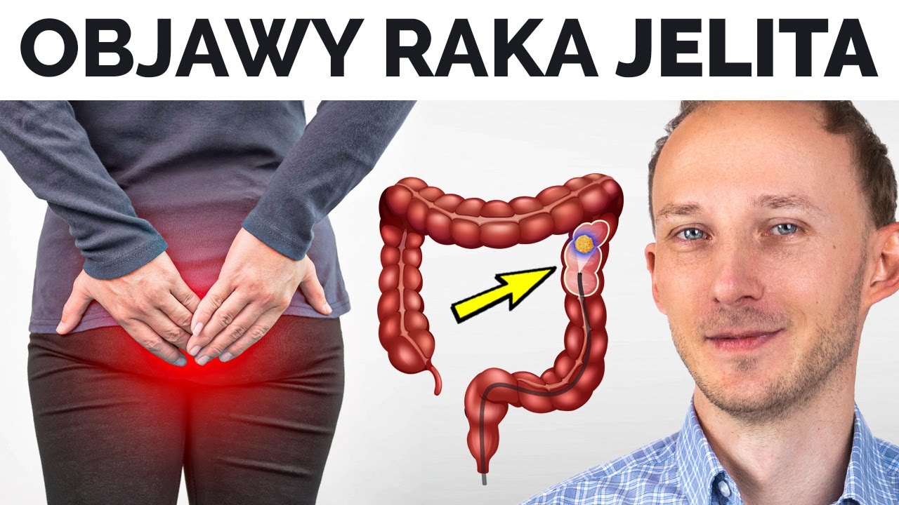 Takie są (wczesne?) objawy RAKA JELITA i co go powoduje