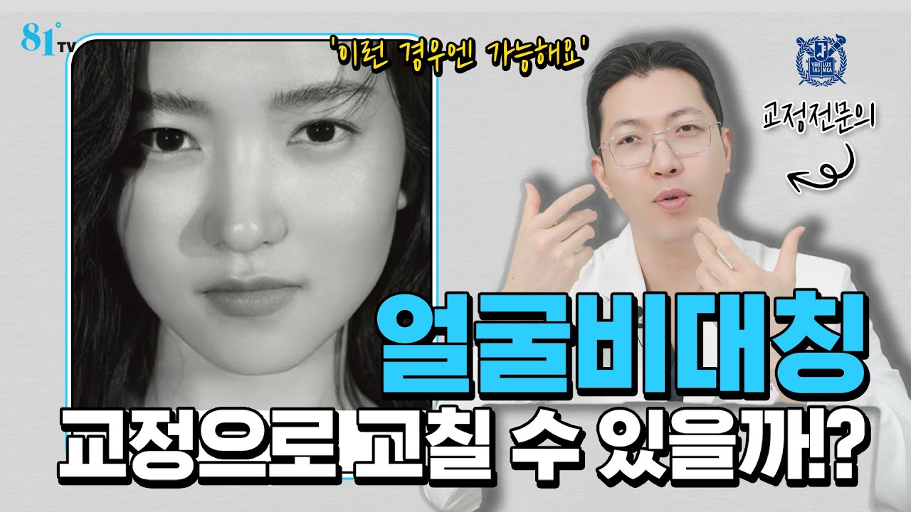 한쪽으로 틀어진 얼굴비대칭, 치아교정으로 가능한 경우는!? 반드시 체크해보세요 ㅣ턱비대칭, 안면비대칭, 입술, 입꼬리 비대칭