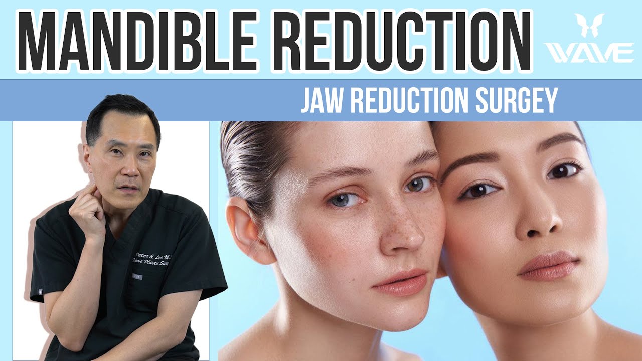 Jaw Reduction Surgery... what to expect from a Mandible Reduction | Wave Plastic Surgery
