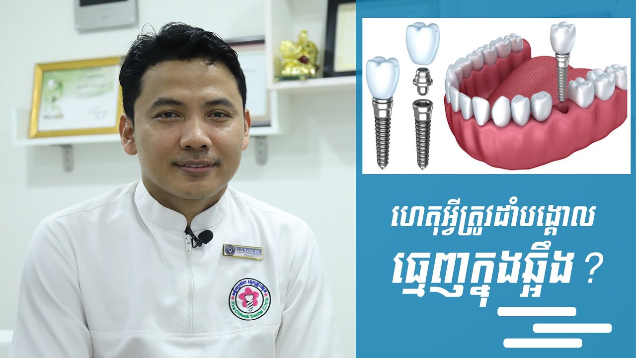 ហេតុអ្វីត្រូវដាំបង្គោលធ្មេញក្នុងឆ្អឹង?