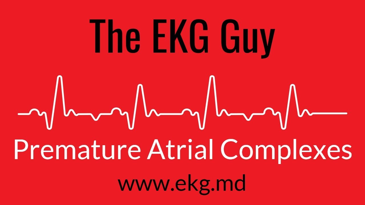 Premature Atrial Complexes EKG l The EKG Guy - www.ekg.md