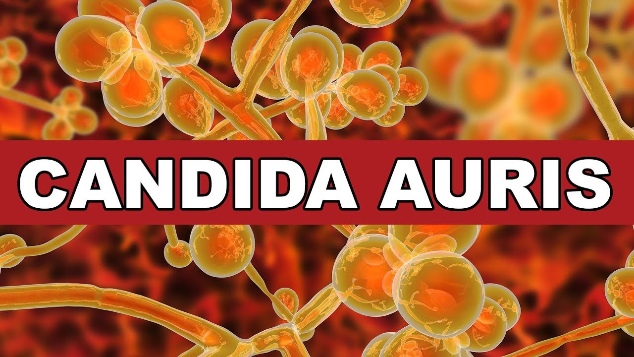Do you know what Candida auris is? You should.