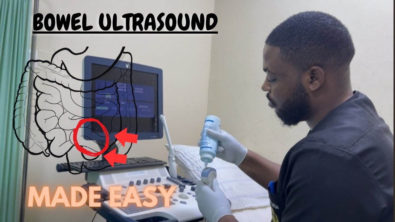 If Bowel Ultrasound Confuses You, This Step-by-Step Method Works