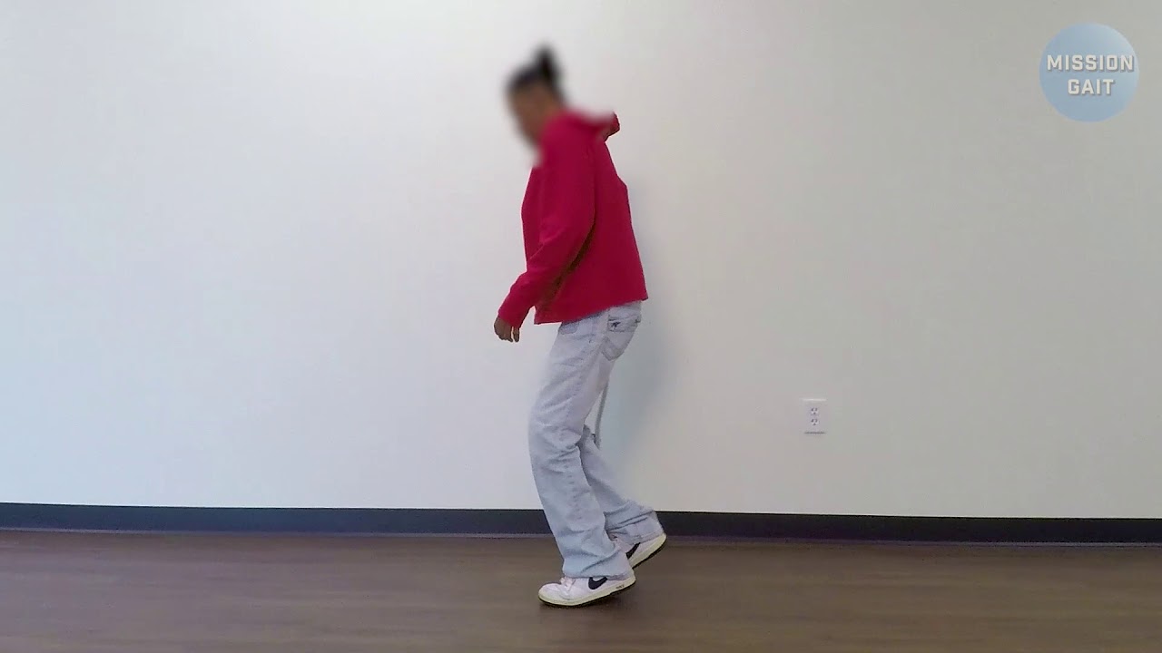 Conradi-Hünermann Gait - Case Study 16 (single underarm crutch)
