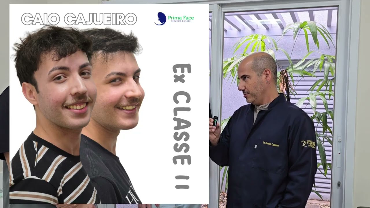 USO DE ALINHADORES ESTÉTICOS INVISÍVEIS PARA A CIRURGIA ORTOGNÁTICA - É POSSÍVEL?