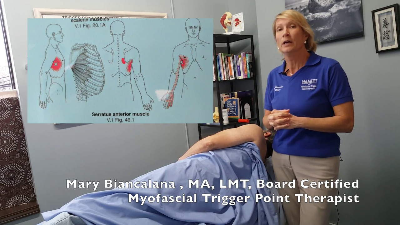 Serratus Anterior; Trigger Point Treatment for Chest or Upper Back Pain