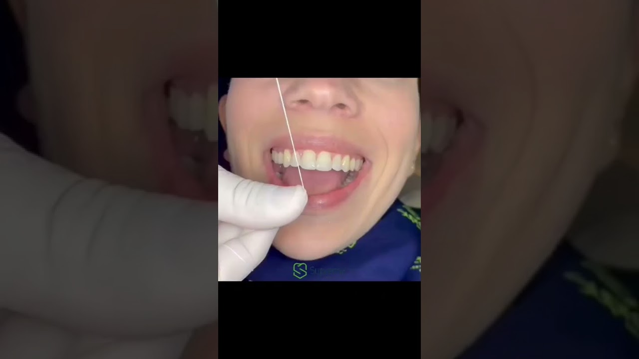 COMO PASSAR FIO DENTAL DA MANEIRA CORRETA