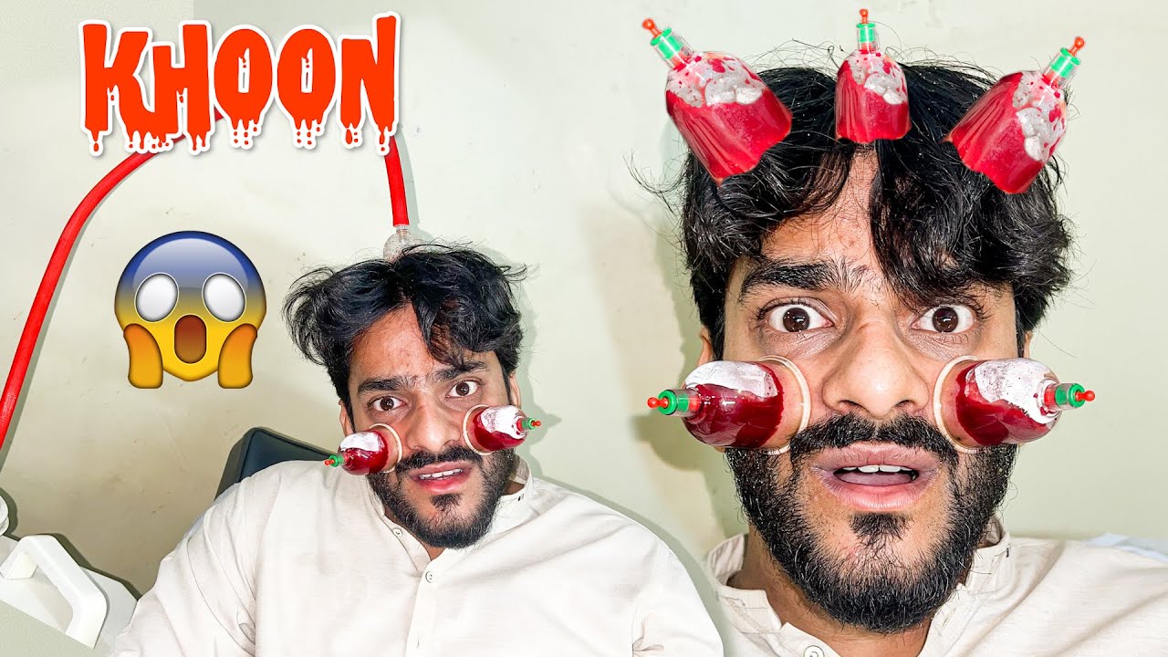 Sar Ka Hijama Karlia 😱 | Mishkat Khan | hijama therapy Vlog
