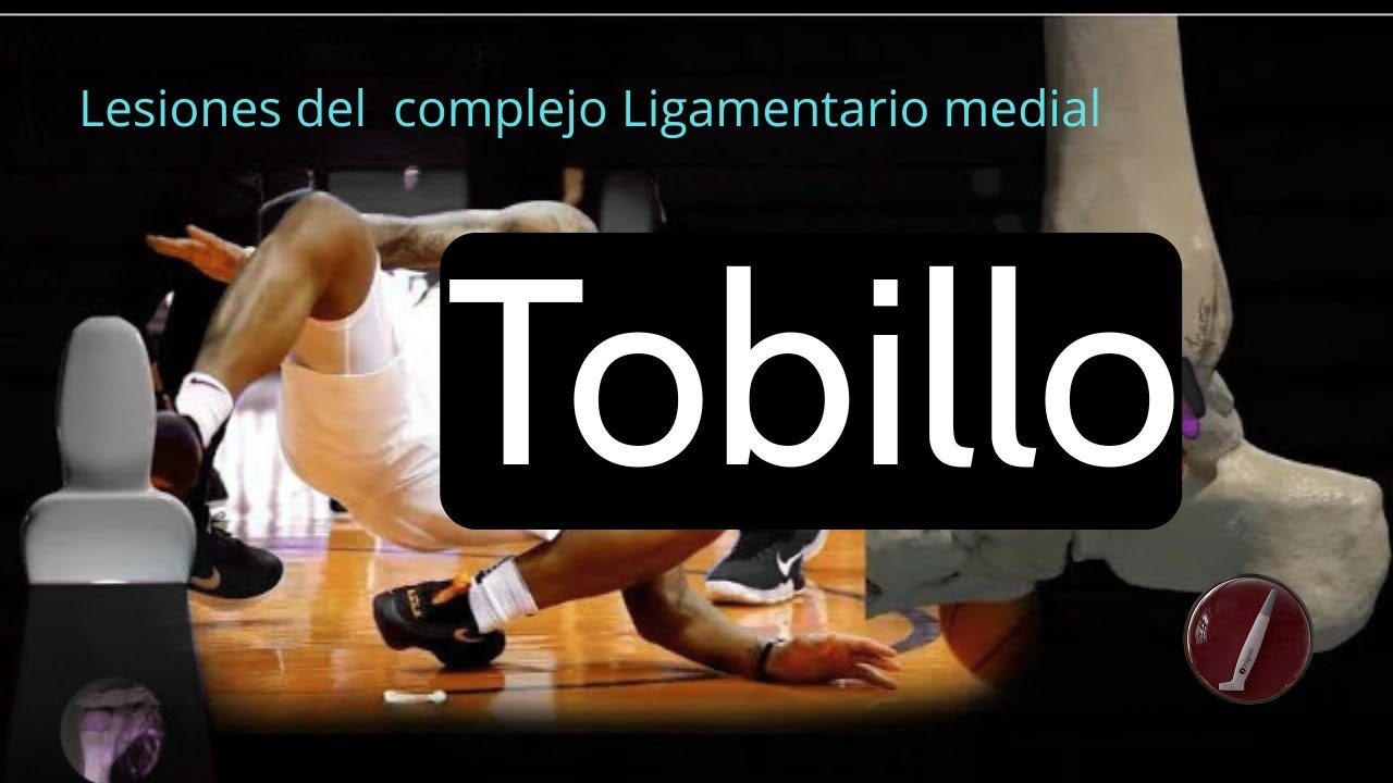 PATOLOGÍA DE LOS LIGAMENTOS MEDIALES DEL TOBILLO | Lesiones en Capa Profunda y Superficial ecografía