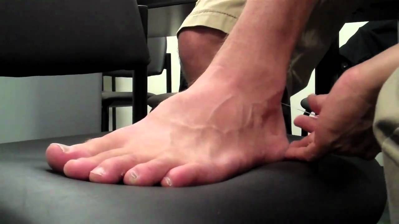 McMaster Medical Acupuncture Program: Acupuncture Point UB 60