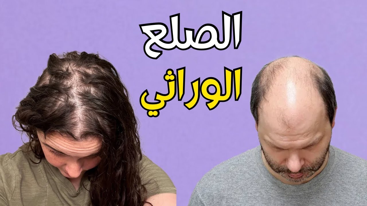 شاهد كيف يحدث تساقط الشعر الوراثي للرجال والنساء |وماهي أفضل الطرق لعلاجة _ Hair Loss Explained