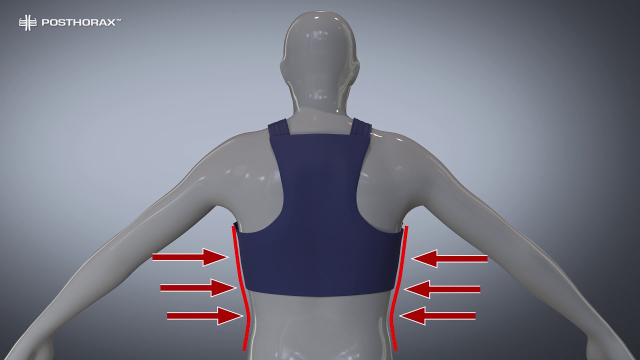 Fitting a POSTHORAX Sternum Support Vest on a Patient