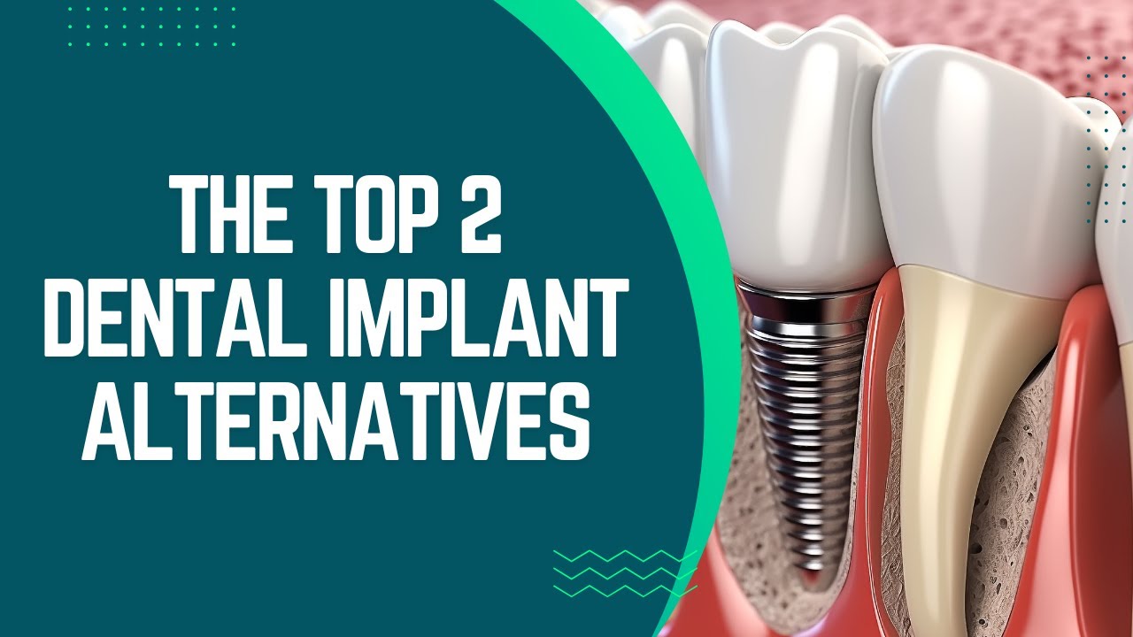 The Top 2 Dental Implant Alternatives: A Complete Guide