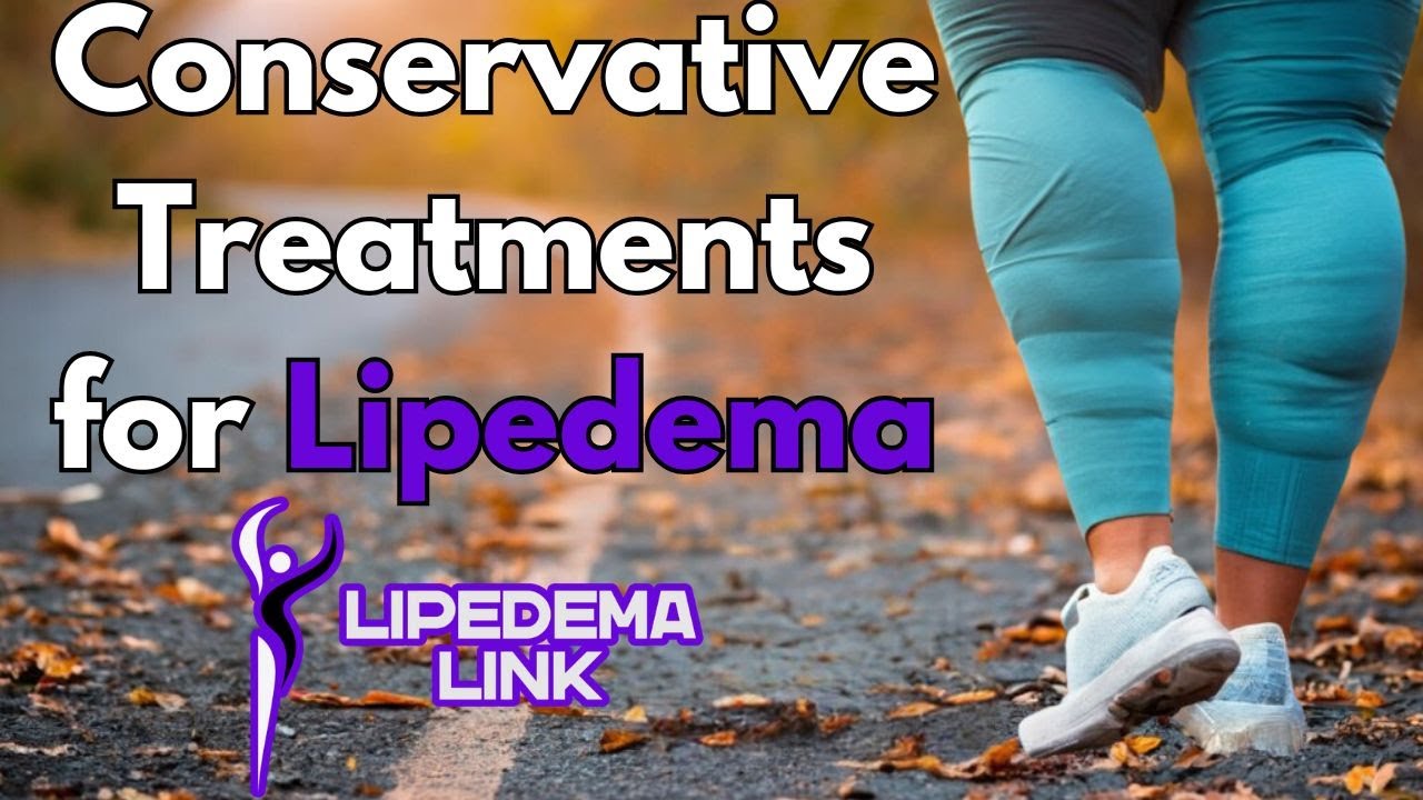 Conservative Treatments for Lipedema - Physical Therapist Explains Compression, Exercise, and More!