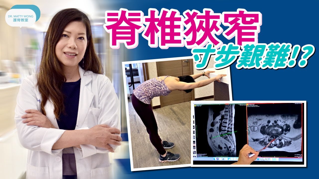 脊椎狹窄寸步艱難! 行路一陣腰腳痛 - 脊醫王鳳恩 -  (中/ Eng Sub) What is Spinal Stenosis- Dr. Matty Wong