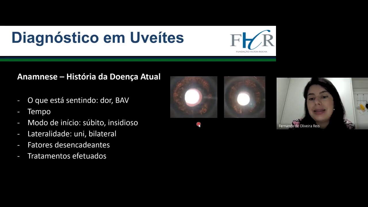 Uveítes  Diagnósticos e Classificação - Sarah Cenachi - Retina