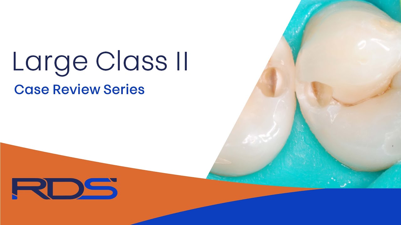 Dental clinical case reviews: Class II restorations