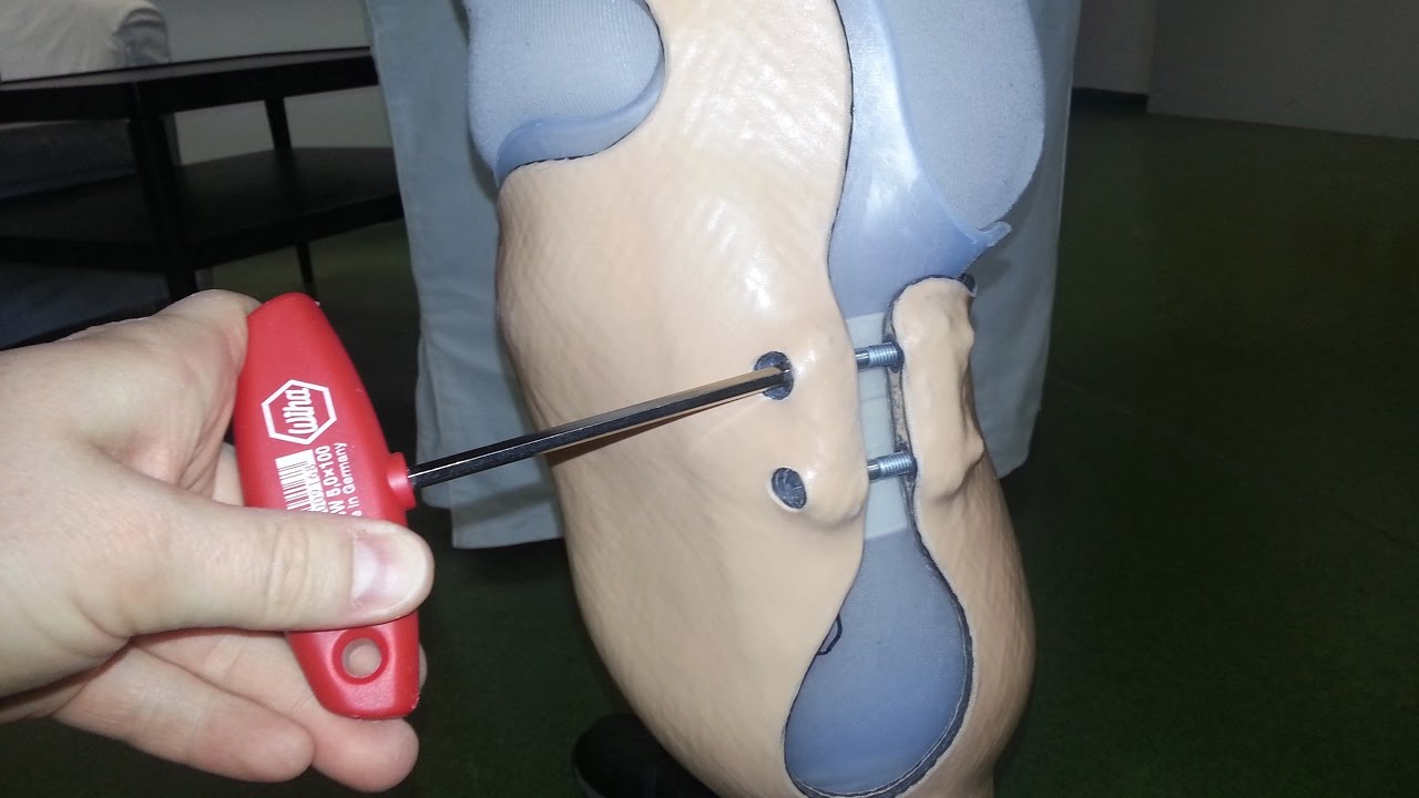 Adjustable Trans Tibial Prosthesis
