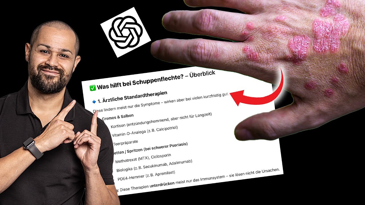 Wie gut hilft ChatGPT bei Schuppenflechte? | Reaction