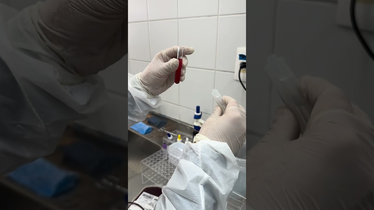 TESTE DE HEMÓLISE