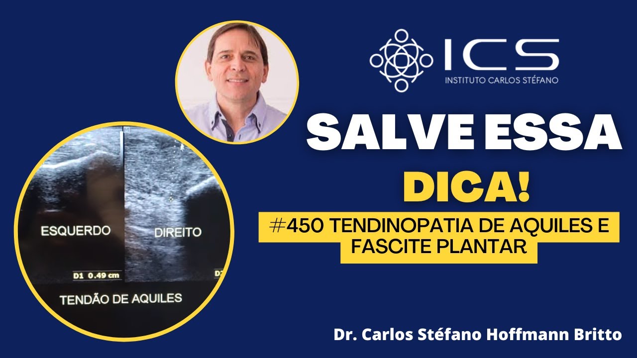 Tendinopatia de Aquiles e fascite plantar