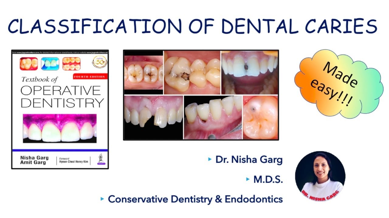 DENTAL CARIES | G.V. BLACK'S CLASSIFICATION | MADE EASY