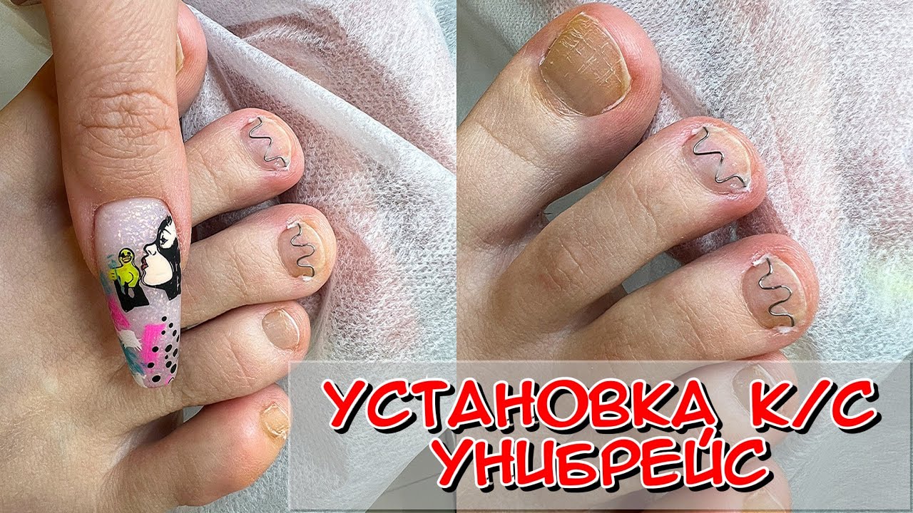 Установка Унибрейс