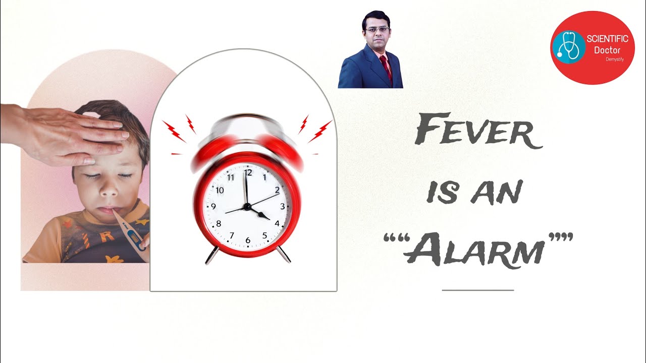 Fever  | Alarm | High grade fever - Always Dangerous