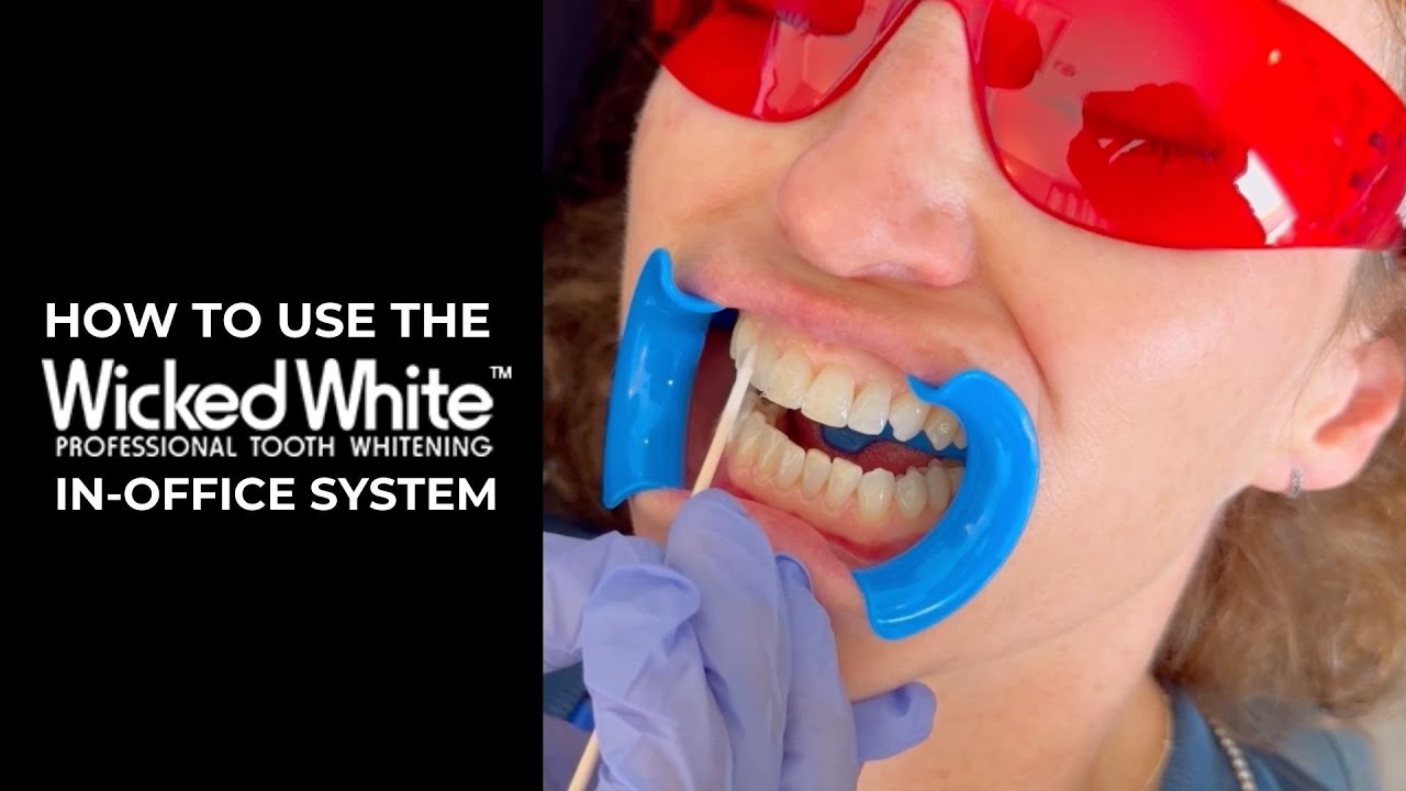 Wicked White Professional Teeth Whitening: In-Office Demo For Dental Pros!