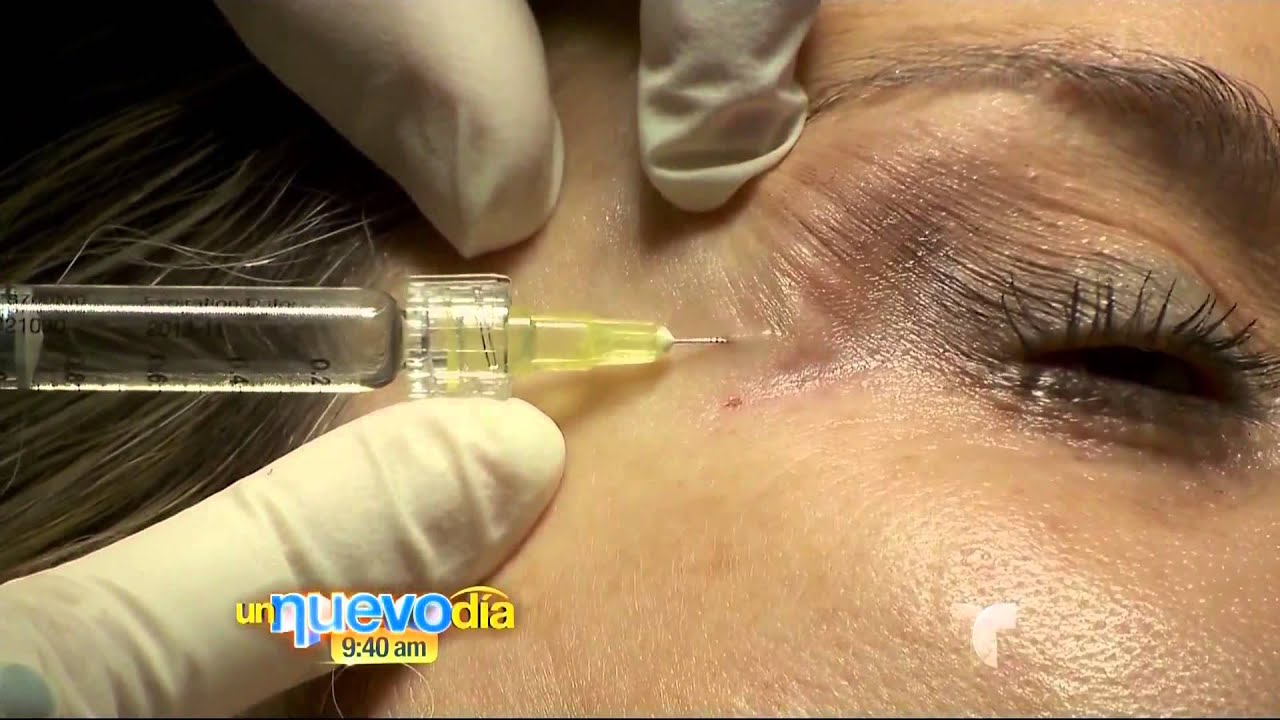 Tecnica Belotero | Un Nuevo Día | Telemundo