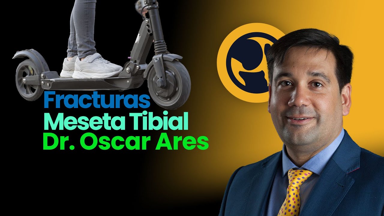 Fractura de meseta tibial - Dr. Oscar Ares