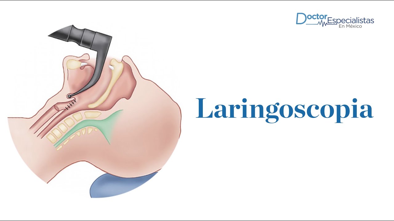 Laringoscopia - Doctor Especialistas Mexico