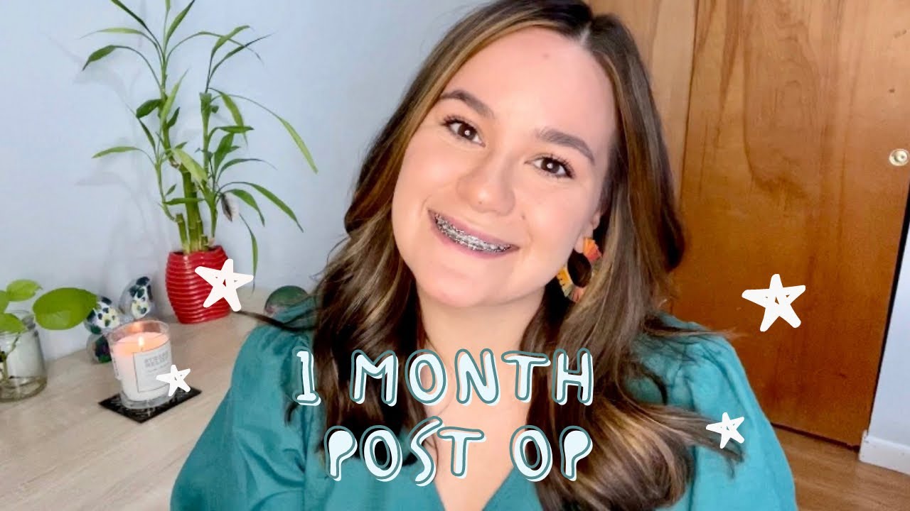 DOUBLE JAW SURGERY | 1 MONTH POST OP + Mental Health Journey