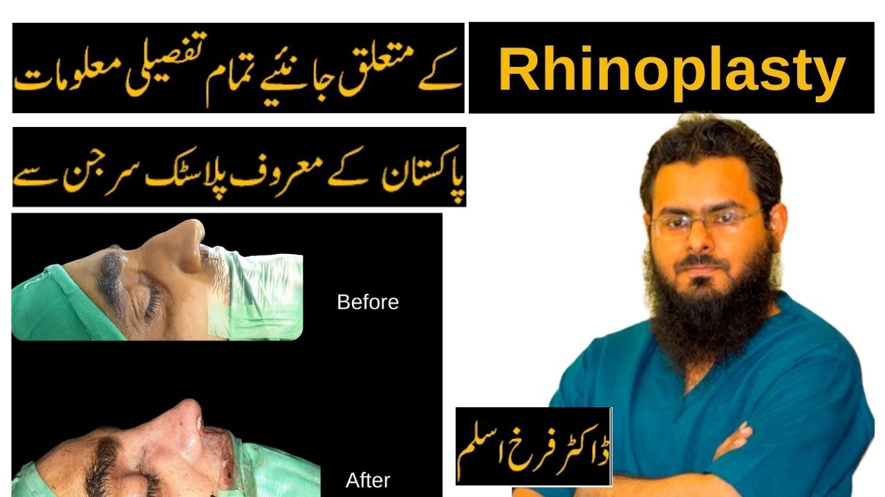 Rhinoplasty in Lahore | Best Rhinoplasty in Lahore Pakistan | Nose job