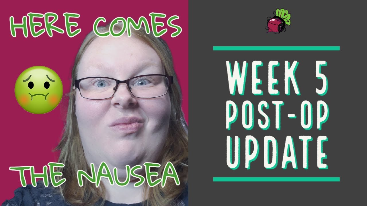 Weight Loss Surgery in Mexico - Week 5 Post-Op Update | My Gastric Bypass Journey
