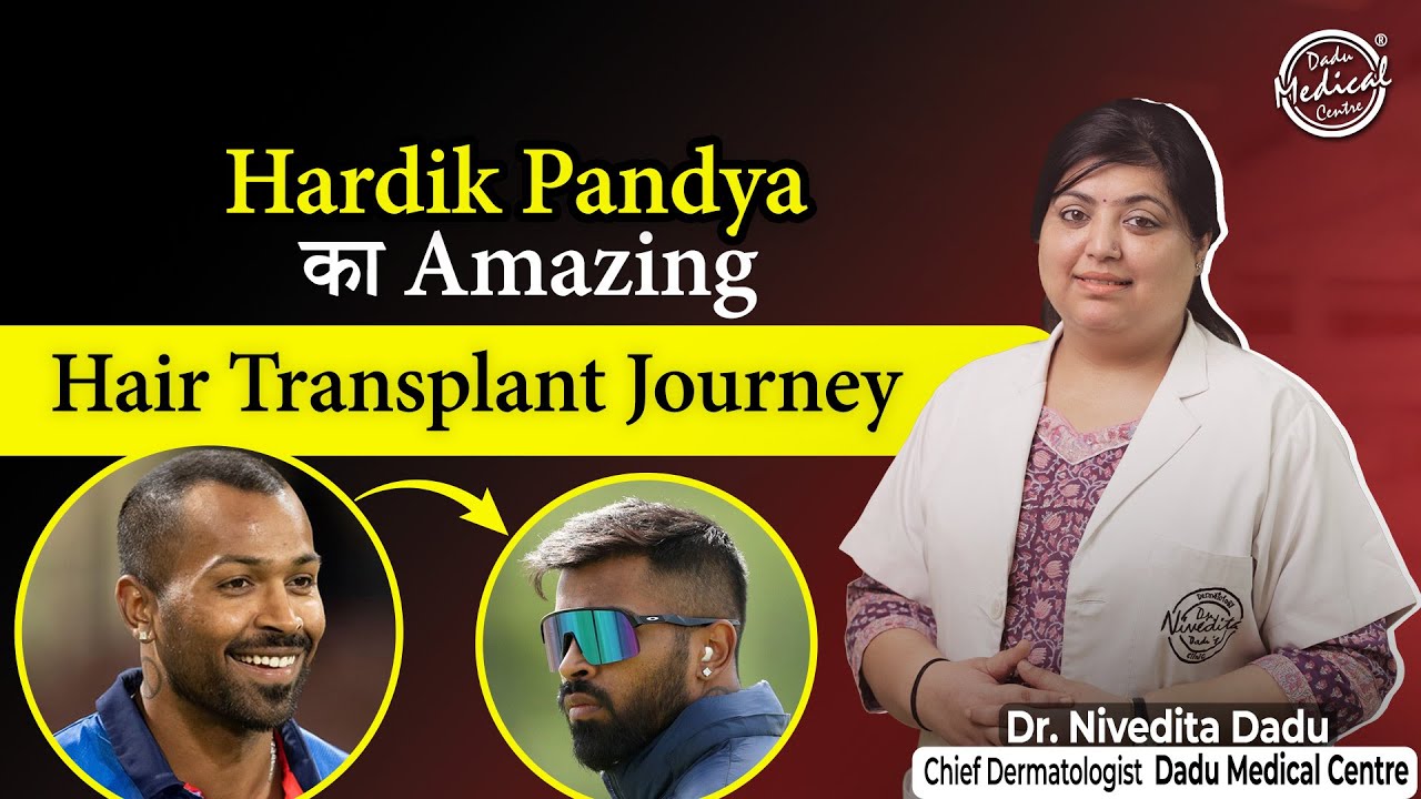 Hardik Pandya's Hair Transplant Journey | Hair Transplant in Delhi at Dadu Medical Centre